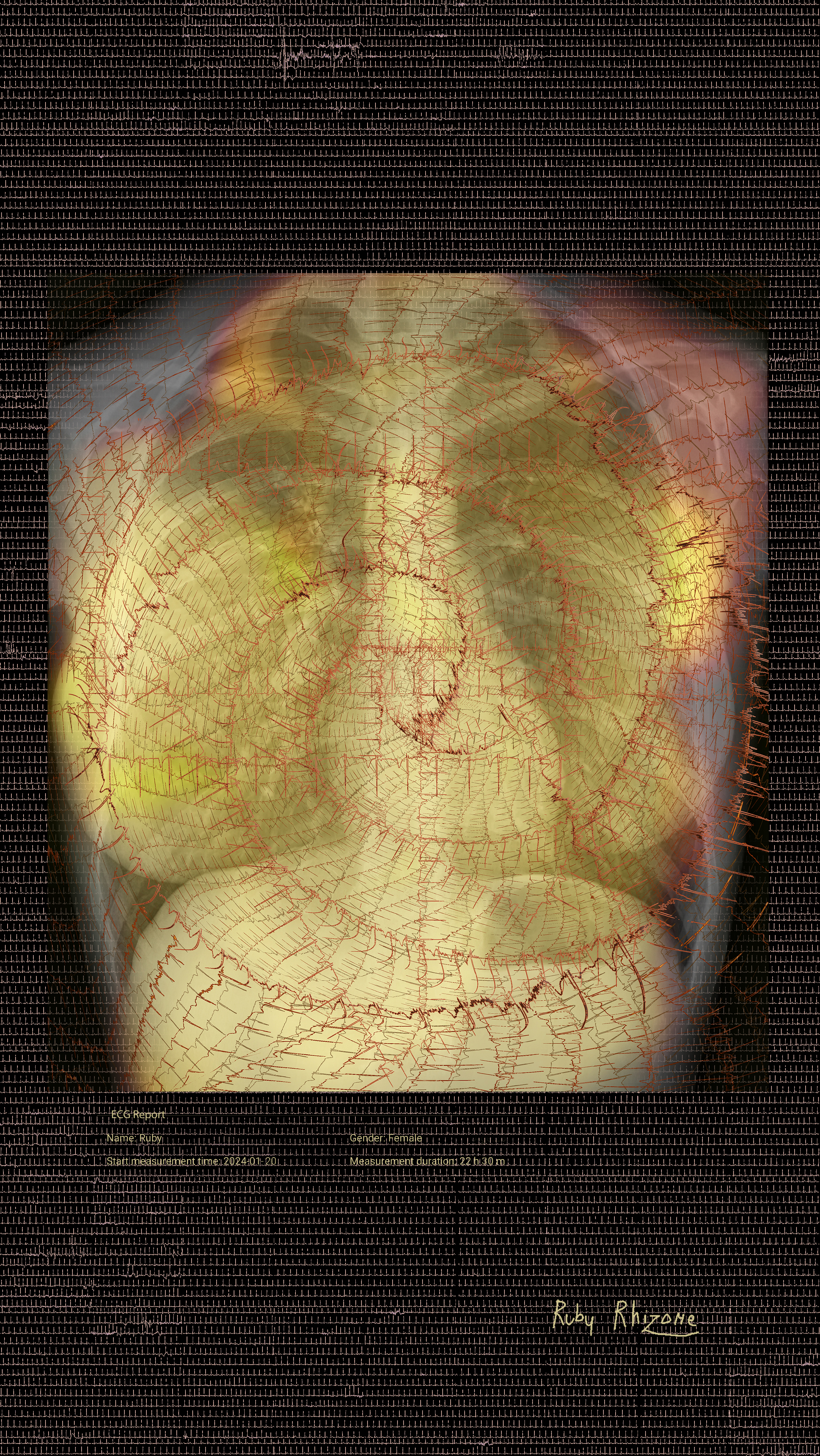 "Day 20" - GENESIS collection