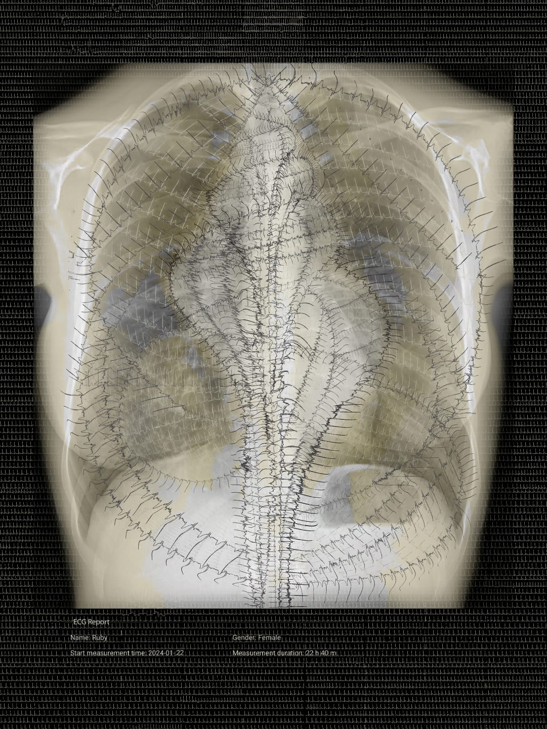 "Day 22" GENESIS collection